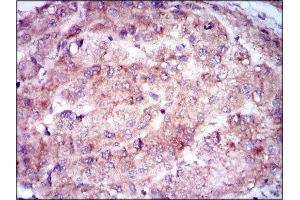 Immunohistochemistry (IHC) image for anti-Enolase 2 (Gamma, Neuronal) (ENO2) (AA 251-433) antibody (ABIN1846262) (ENO2/NSE anticorps  (AA 251-433))