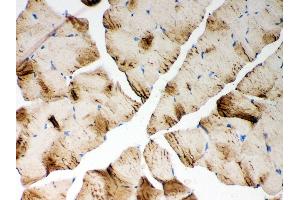 Anti- ATP2A1 antibody, IHC(P) IHC(P): Mouse Skeletal Muscle Tissue