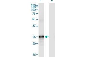 Western Blot analysis of FGF19 expression in transfected 293T cell line by FGF19 monoclonal antibody (M01), clone 4C4. (FGF19 anticorps  (AA 1-216))
