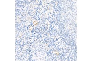 Immunohistochemistry of paraffin-embedded human colon using Caspase-7 Rabbit pAb (ABIN3022071, ABIN3022072, ABIN3022073 and ABIN6218596) at dilution of 1:150 (40x lens).