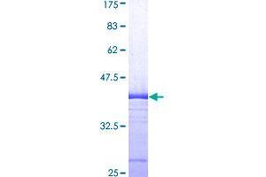 Image no. 1 for Autocrine Motility Factor Receptor (AMFR) (AA 451-550) protein (GST tag) (ABIN1344980)