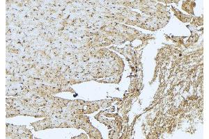 ABIN6273408 at 1/100 staining Mouse muscle tissue by IHC-P. (TNNT3 anticorps  (C-Term))