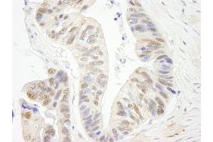 anti-DNA Repair Protein Complementing XP-G Cells (ERCC5) (AA 650-700) antibody