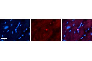 Rabbit Anti-APTX Antibody   Formalin Fixed Paraffin Embedded Tissue: Human heart Tissue Observed Staining: Nucleus Primary Antibody Concentration: 1:100 Other Working Concentrations: N/A Secondary Antibody: Donkey anti-Rabbit-Cy3 Secondary Antibody Concentration: 1:200 Magnification: 20X Exposure Time: 0. (Aprataxin anticorps  (N-Term))