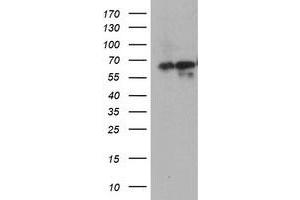 Western Blotting (WB) image for anti-5-Aminoimidazole-4-Carboxamide Ribonucleotide Formyltransferase/IMP Cyclohydrolase (ATIC) antibody (ABIN1496504) (ATIC anticorps)