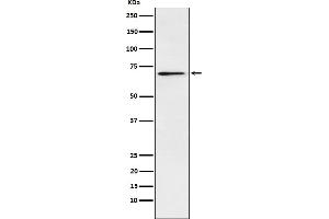 Western blot analysis of Plastin L expression in Jurkat cell lysate.
