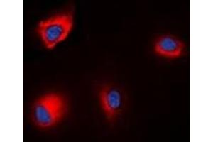 Immunofluorescent analysis of ANAPC1 (pS688) staining in HEK293T cells. (APC1 anticorps  (pSer688))