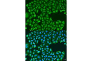 Immunofluorescence analysis of U2OS cells using TIRAP antibody. (TIRAP anticorps  (AA 1-221))