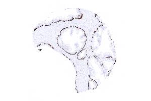 Strong KRT14 positivity in basal cells of the prostate