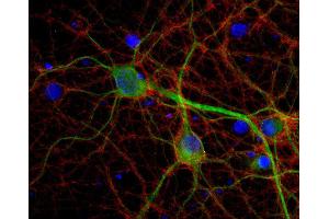 Indirect immunostaining of PFA fixed rat hippocampus neurons with anti-Munc18-1, (dilution 1 : 500; red) and mouse anti-MAP 2 (cat.