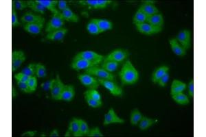 Immunofluorescence staining of HepG2 cells with ABIN7148706 at 1:200, counter-stained with DAPI.
