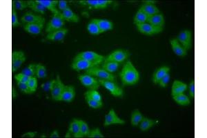 Immunofluorescence staining of HepG2 cells with ABIN7148706 at 1:200, counter-stained with DAPI. (CTAGE1 anticorps  (AA 471-595))