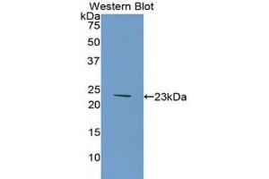 Western blot analysis of the recombinant protein. (COL6A1 anticorps  (AA 828-1022))