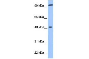 PYGO1 antibody used at 0.
