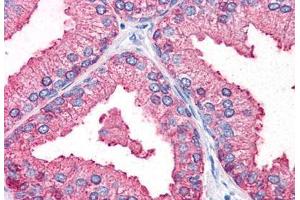 Human Prostate (formalin-fixed, paraffin-embedded) stained with DC2 antibody ABIN351430 at 10 ug/ml followed by biotinylated goat anti-rabbit IgG secondary antibody ABIN481713, alkaline phosphatase-streptavidin and chromogen.