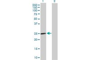 Western Blot analysis of AGPAT2 expression in transfected 293T cell line by AGPAT2 MaxPab polyclonal antibody. (AGPAT2 anticorps  (AA 1-278))