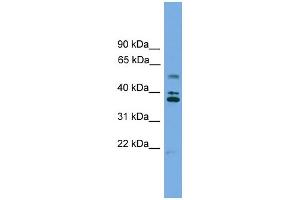 WB Suggested Anti-LDLRAD3 Antibody Titration: 0. (LDLRAD3 anticorps  (Middle Region))