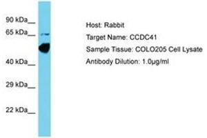 Image no. 1 for anti-Coiled-Coil Domain Containing 41 (CCDC41) (AA 148-197) antibody (ABIN6750609) (CCDC41 anticorps  (AA 148-197))
