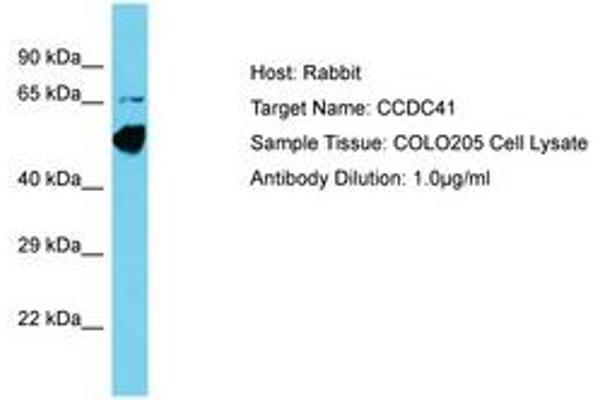 CCDC41 Antikörper  (AA 148-197)