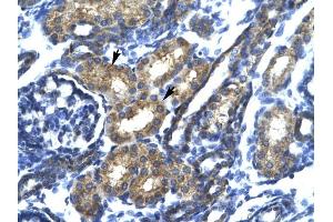 SP140 antibody was used for immunohistochemistry at a concentration of 4-8 ug/ml to stain Epithelial cells of renal tubule (arrows) in Human Kidney. (SP140 anticorps  (N-Term))