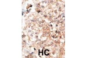 Immunohistochemistry (IHC) image for anti-Osteocalcin (BGLAP) antibody (ABIN3001265) (Osteocalcin anticorps)
