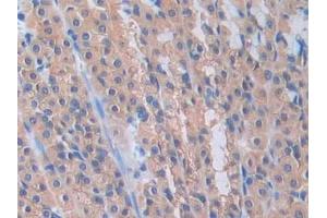 DAB staining on IHC-P; Samples: Rat Stomach Tissue (PANX1 anticorps  (AA 77-260))