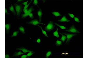 Immunofluorescence of monoclonal antibody to CYTH2 on HeLa cell. (Cytohesin 2 anticorps  (AA 314-398))