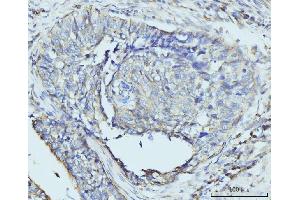IHC analysis of RPL23 using anti-RPL23 antibody (ABIN7599808).