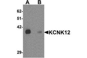 Western blot analysis of KCNK12 in rat brain tissue lysate with KCNK12 Cat. (KCNK12 anticorps  (C-Term))