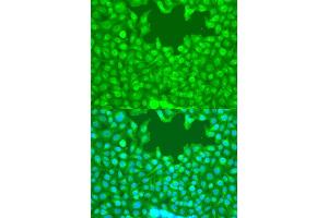 Immunofluorescence analysis of U2OS cells using TAZ antibody (ABIN7271395) at dilution of 1:100.