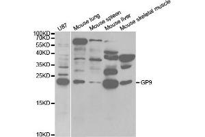 Western Blotting (WB) image for anti-Glycoprotein IX (Platelet) (GP9) antibody (ABIN1876562) (CD42a anticorps)