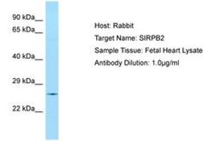 Image no. 1 for anti-Signal-Regulatory Protein beta 2 (SIRPb2) (AA 110-159) antibody (ABIN6750071) (SIRPb2 anticorps  (AA 110-159))