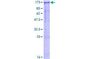 Image no. 1 for Smg-5 Homolog, Nonsense Mediated mRNA Decay Factor (SMG5) (AA 1-1016) protein (GST tag) (ABIN1320676)