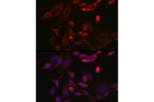 Immunofluorescence analysis of NIH/3T3 cells using BNIP3L Rabbit pAb (ABIN6129989, ABIN6137622, ABIN6137623 and ABIN6221881) at dilution of 1:100 (40x lens). (BNIP3L/NIX anticorps  (AA 1-187))