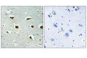 Immunohistochemical analysis of paraffin-embedded human colon carcinoma tissue using 4E-BP1 (Ab-69) antibody.