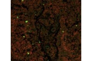 Immunofluorescence analysis of CD19 antibody with paraffin-embedded human lymph tissue.