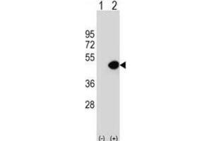 Western Blotting (WB) image for anti-Dynactin 2 (p50) (DCTN2) antibody (ABIN2997015)
