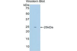 Western blot analysis of the recombinant protein. (EPAS1 anticorps  (AA 339-541))