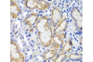 Immunohistochemistry of paraffin-embedded Mouse kidney using HCLS1 Polyclonal Antibody at dilution of 1:100 (40x lens). (HCLS1 anticorps)