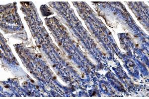 IHC analysis of TRIM25/EFP using anti-TRIM25/EFP antibody (ABIN7599491).