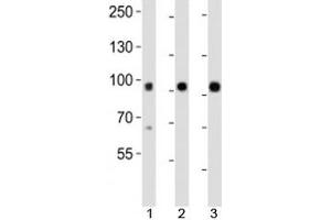 Western blot analysis of lysate from mouse 1) kidney, 2) lung and 3) skin tissue using Epha1 antibody at 1:1000. (EPHA1 anticorps  (N-Term))