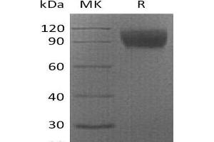 Western Blotting (WB) image for Colony Stimulating Factor 1 Receptor (CSF1R) protein (His tag) (ABIN7320966)