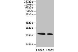 Western blot All lanes: Bovine milk Beta-lactoglobulin antibody at 2 μg/mL Lane 1: Bovine milk Beta-lactoglobulin at 0. (Beta Lactoglobulin (LGB) anticorps)