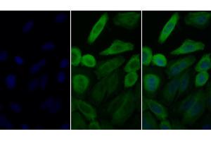 Detection of HSP90aA1 in Human HepG2 cell using Polyclonal Antibody to Heat Shock Protein 90 kDa Alpha A1 (HSP90aA1)