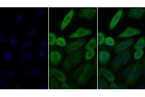 Detection of HSP90aA1 in Human HepG2 cell using Polyclonal Antibody to Heat Shock Protein 90 kDa Alpha A1 (HSP90aA1) (HSP90AA1 anticorps  (AA 698-732))