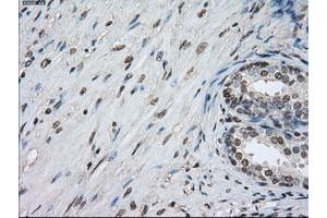 Image no. 3 for anti-Protein Phosphatase 5, Catalytic Subunit (PPP5C) antibody (ABIN1500389)