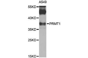 Western blot analysis of extracts of A-549 cells, using PRMT1 antibody (ABIN1874325) at 1:1000 dilution. (PRMT1 anticorps)
