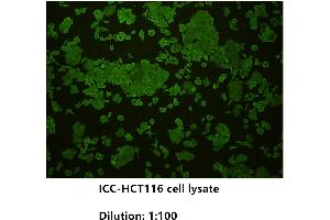 Immunocytochemistry (ICC) image for anti-Cadherin 1, Type 1, E-Cadherin (Epithelial) (CDH1) (Extracellular) antibody (ABIN1854887)