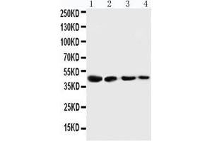 Anti-Cystathionase antibody, Western blotting Lane 1: SMMC Cell Lysate Lane 2: HT180 Cell Lysate Lane 3: HELA Cell Lysate Lane 4: U87 Cell Lysate