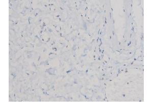 ABIN6267463 at 1/200 staining Human esophagus tissue sections by IHC-P. (CDC25A anticorps  (pSer75))